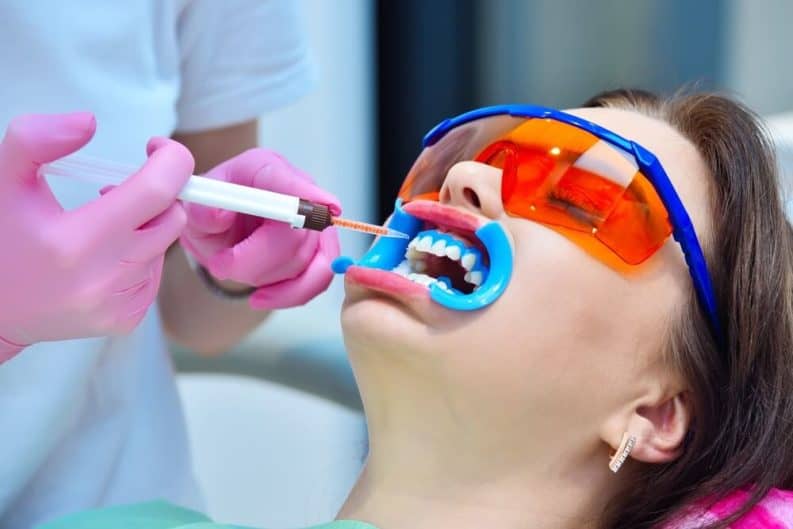 Get a brighter smile in minutes with instant results whitening Eastbourne