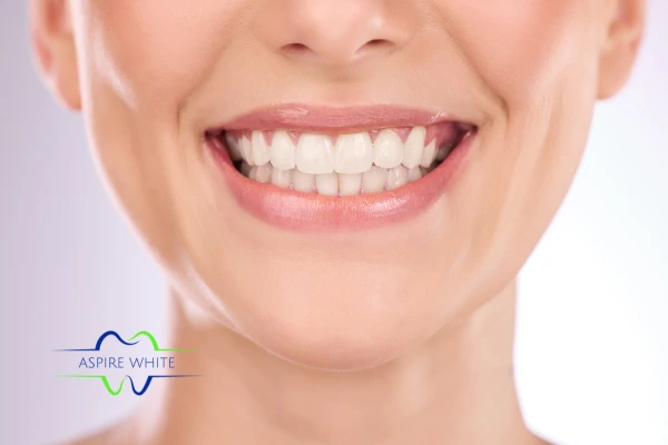 Aspire White After Care tips Eastbourne