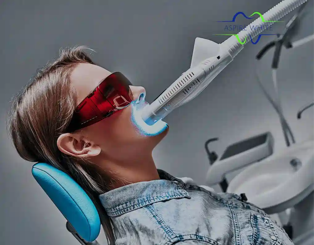 1 Hour Teeth Whitening with Aspire White Eastbourne