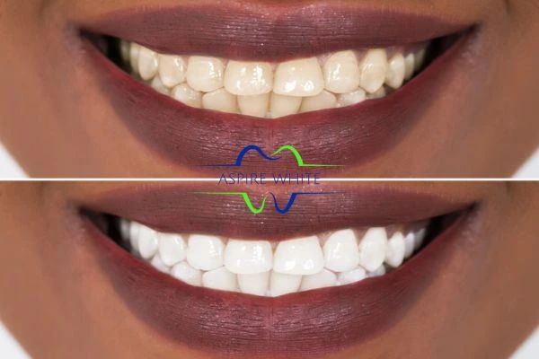 Side-by-side comparison showing before and after results of a cosmetic treatment Eastbourne