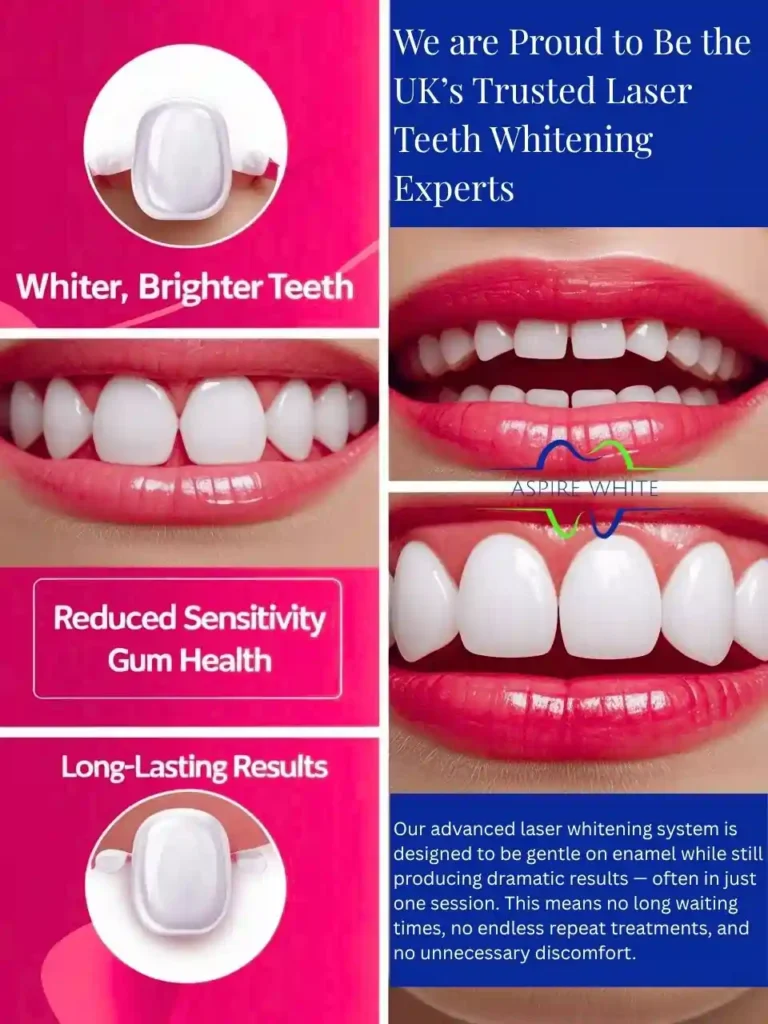 We are Proud to Be the UK’s Trusted Laser Teeth Whitening Experts Eastbourne