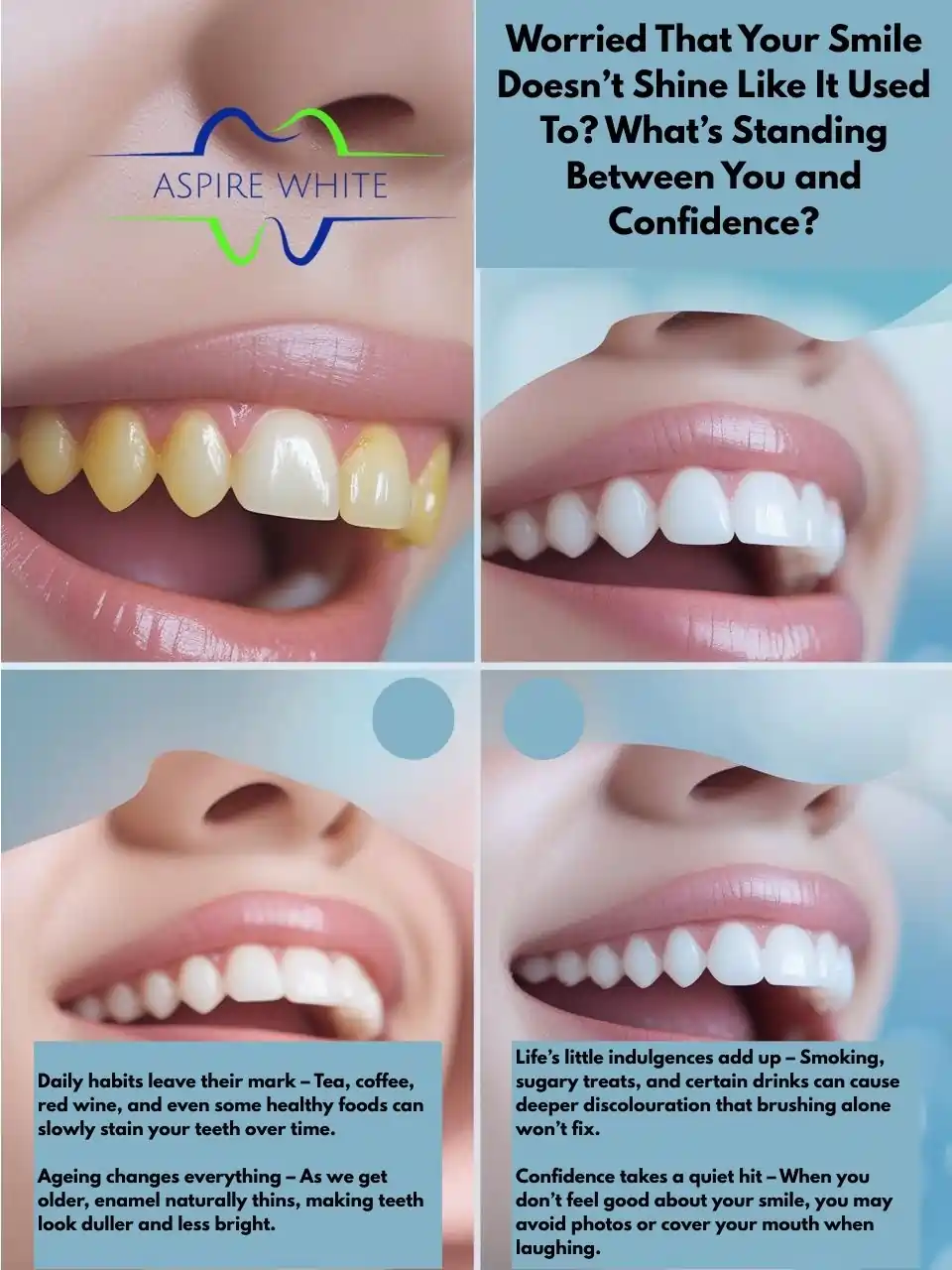 Worried That Your Smile Doesn’t Shine Like It Used To What’s Standing Between You and Confidence Eastbourne